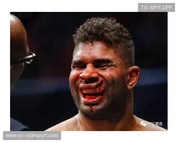 UFC重拳对轰赛季最燃，对手被打到护栏变形